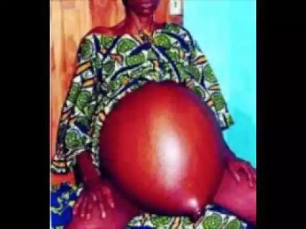 Unbelievable! Villagers in Shock as Woman Gives Birth to Frog